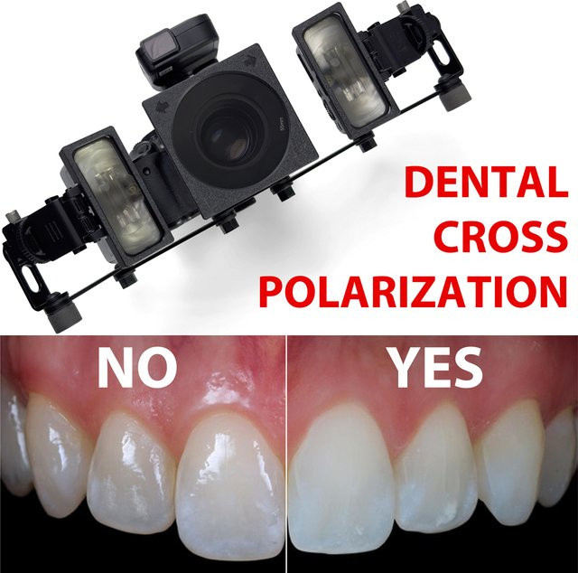 Godox Dental Cross Polarisation Kit MF12 für Kamerablitz in Schwarz zur Vermeidung von Reflexionen und Blendung für die zahnärztliche Fotografie - Bild 1