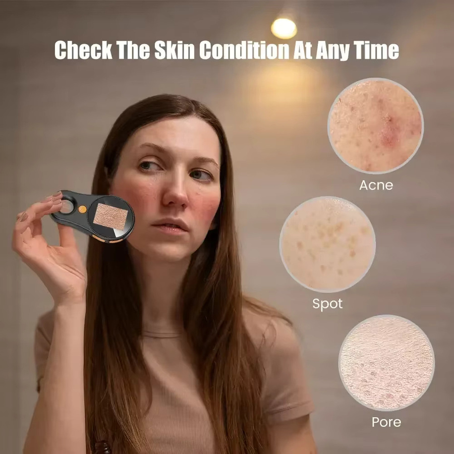 SALORIE Handheld-Dermatoskop-Hautanalysator, kabelloses digitales Mikroskop für Kopfhaut und Haare - Bild 3