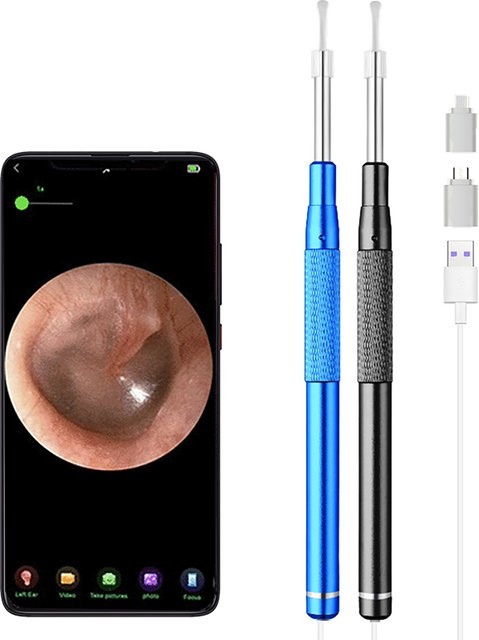 GUANMOU Ohrreiniger-Endoskop 5,5 mm HD Smart 3-in-1 Digital-Endoskop - Bild 1