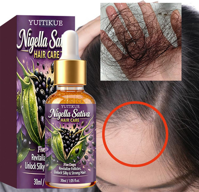 YUITIKUE Nigella Sativa Haarpflegeöl, 30 ml - Bild 1