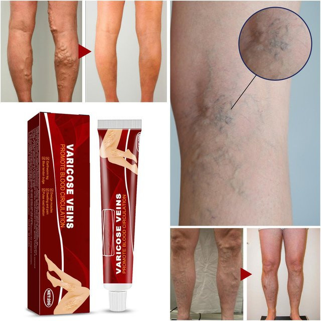 Venoheal Paste, Körperpflege, Unisex - Bild 1