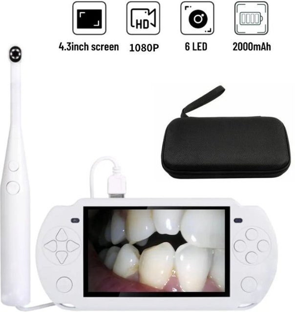 Luxmart Mini Home Intraorale Endoskopkamera 3-in-1 USB mit 4,5 Zoll HD Bildschirm für Android und PC in Schwarz oder Weiß - Bild 1