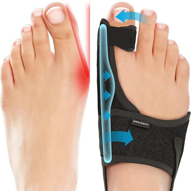 Voguish Hallux Valgus Korrektor Edelstahl, Zehenstrecker, White - Bild 1