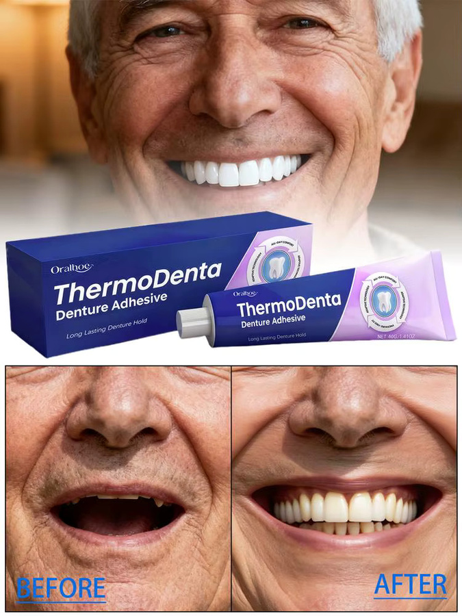 eelhoe Zahnfixierungskleber, thermoplastischer Prothesenkleber - Bild 6
