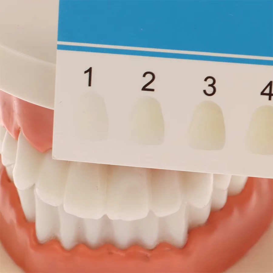 LGFU Dental Farbkarte Zähne Bleaching Vergleichskarten, 10 Stück - Bild 2