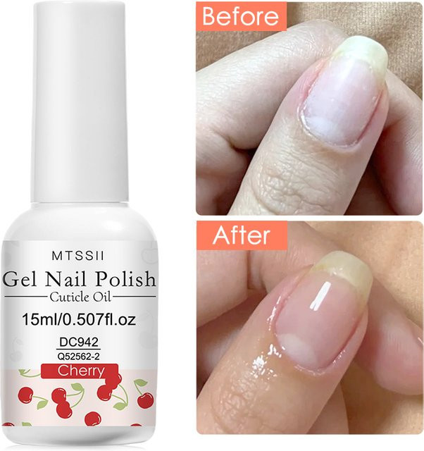 Mtssii Nagelhautöl mit Vitamin C, 15 ml, Unisex - Bild 1