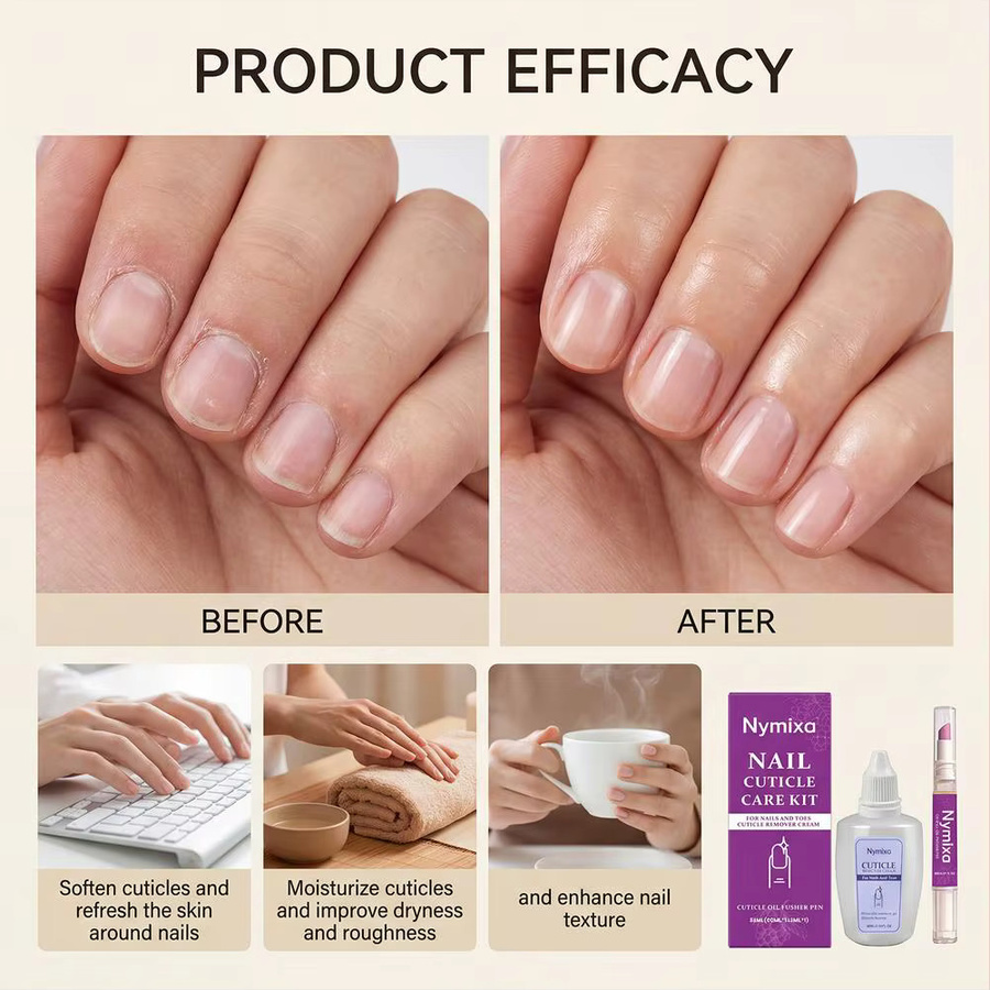 SADOER Nagelhautpflege-Set, Nagelweichmacher-Öl, Unisex - Bild 3