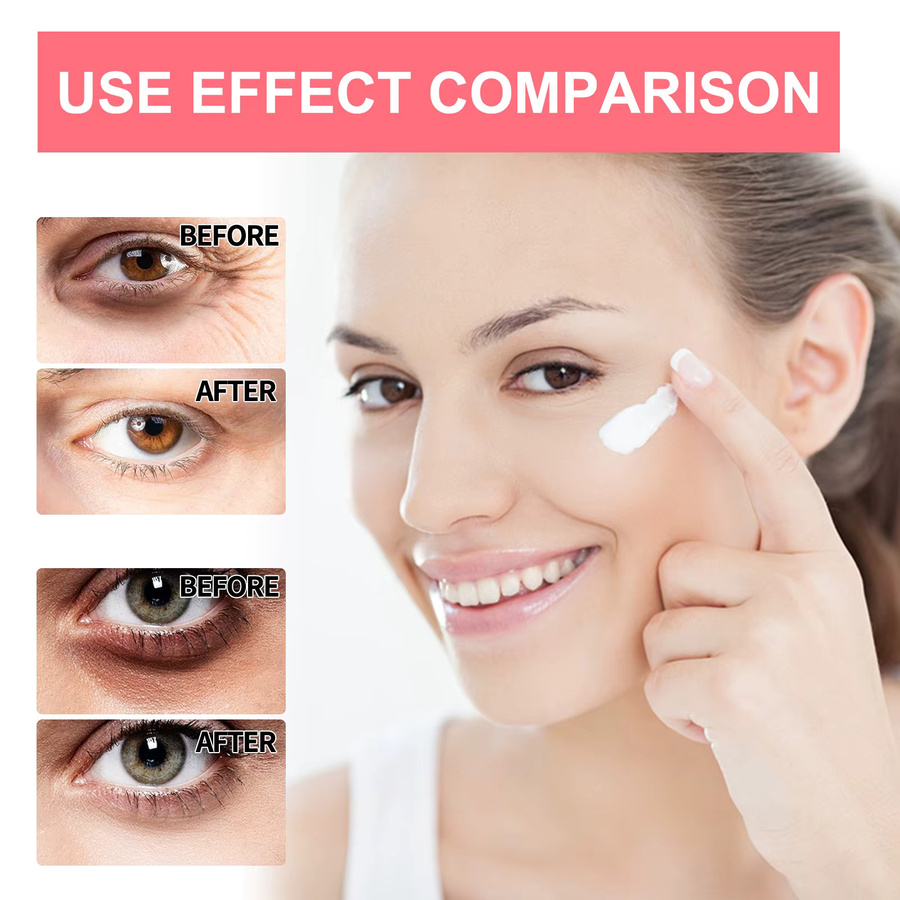 eelhoe Retinol Augencreme Stick, Unisex - Bild 2