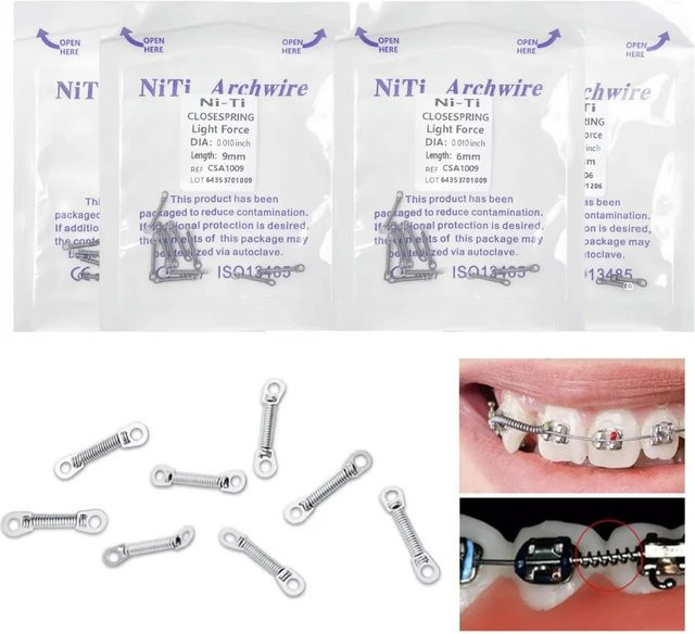 NEWLLEXX Kieferorthopädische Schraubenfedern aus Nickel-Titan, 10 Stück - Bild 1